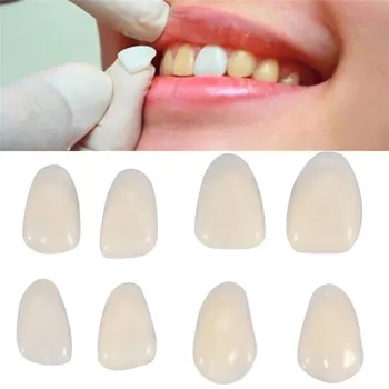 50 бр. фасети на зъбите от стоматологична смола, ультратонкая временна корона, избелваща порцеланови зъби, фасети е медицински, полимерни зъби за грижи за зъбите